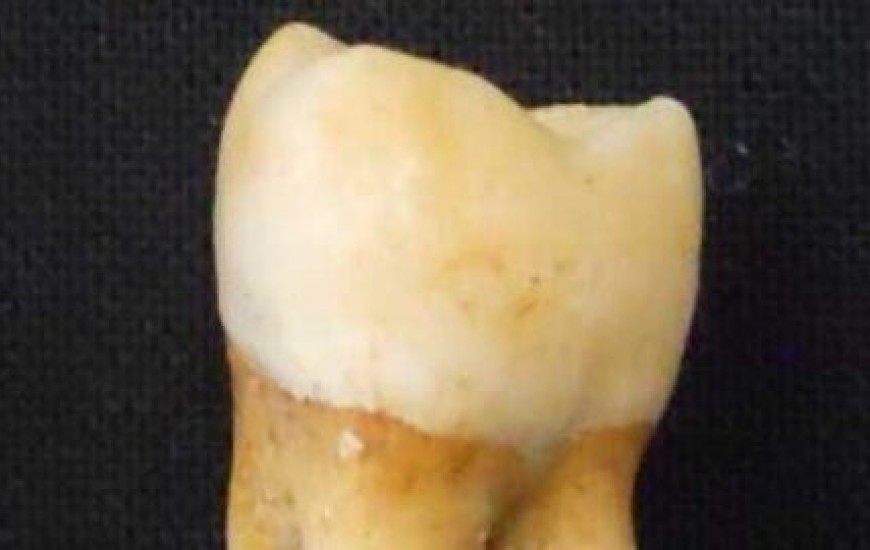 آیا مینای دندان جنسیت بقایای چندهزار ساله انسان تعیین می‌کند؟